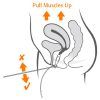 La Sonda Vaginal Periform+ se presenta en un envase estéril, asegurando su higiene y seguridad para su uso inmediato en tratamientos de rehabilitación del suelo pélvico. Explicación de Sonda Vaginal Periform+ presentada en su envase estéril, lista para su uso clínico o domiciliario.