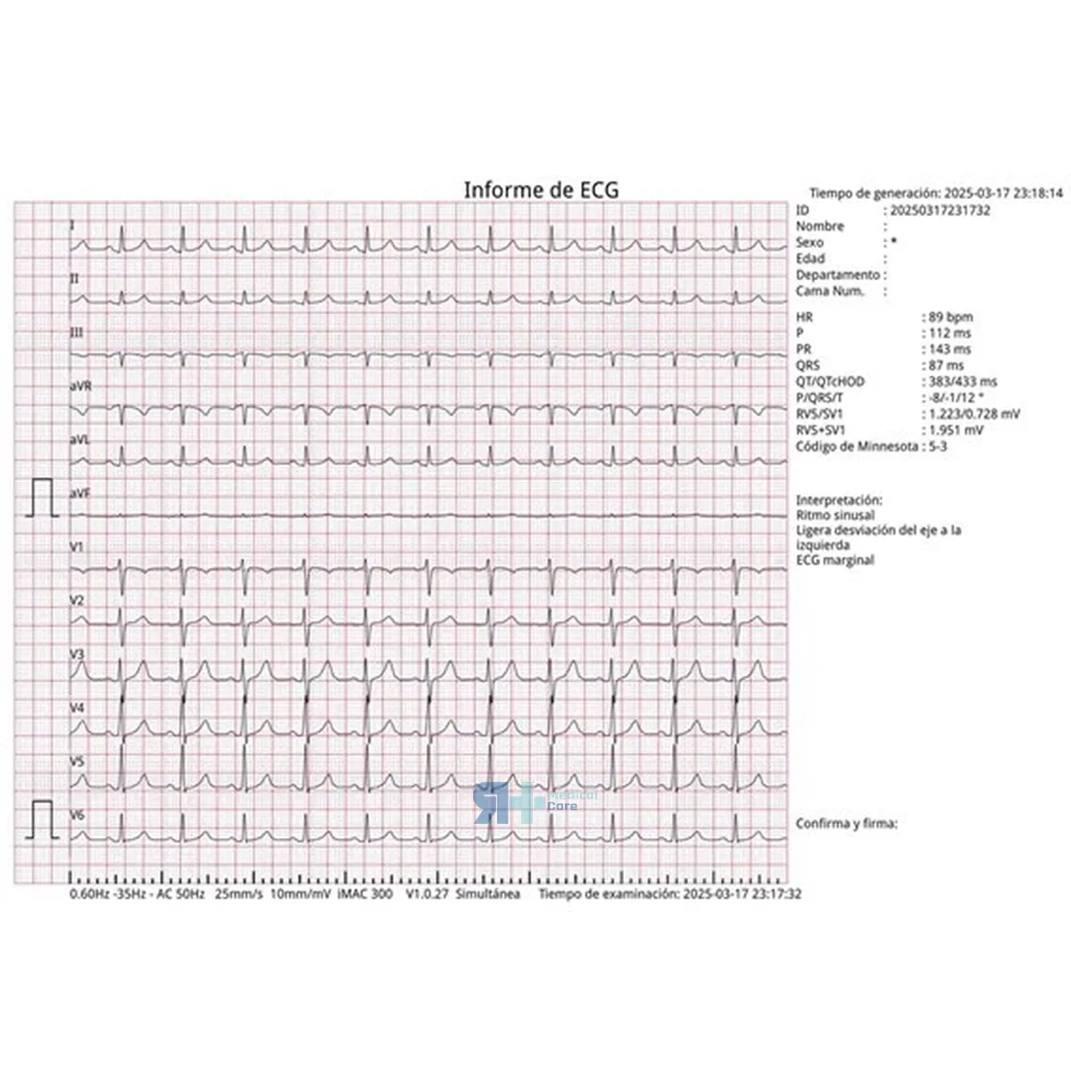 Electrocardiógrafo de 12 Canales iMAC 300